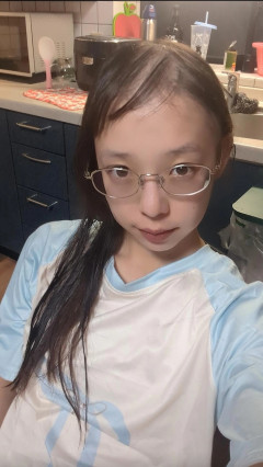 “脱毛症”の美少女が発見される