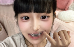 X女子「今日朝から歯を一気に治療してもらいました～」ﾊﾟｼｬｯ→とんでもない見た目になってしまう・・・