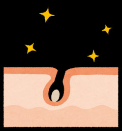 男カメラマンと脱毛の話題で盛り上がる女友達⇒「私ワキやってるよw」と平気で明かす距離感に絶句←え？w