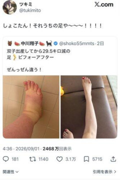 【悲報】X民「しょこたん！それうちの足や～～！」万バズ➞中川翔子さん「だからXって嫌」・・・・・・・・・