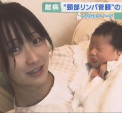 【悲報】娘が重度の障害児だと分かった美人ママさん、目が変わり果ててしまう