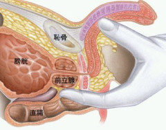 前立腺王ワイ、会陰をトントンするだけでメスイキする身体に進化ｗｗｗｗｗｗｗｗ