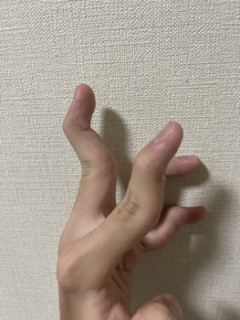 指エグい曲がり方するんだけど自分だけ？（※画像あり）