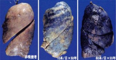 タバコを吸った肺、真っ黒すぎてやばい。（おまえらの想像以上にやばい）