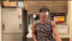 【悲報】堀大輔、1日30分睡眠を5日間やってみた結果、目の充血が隠しきれず眼帯をつけ始める