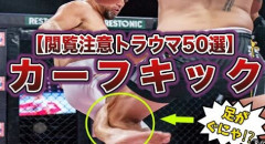 【悲報】プロ格闘家「カーフキックを禁止にしろ！」→大炎上