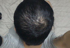 【画像】43歳だがヤバいか？