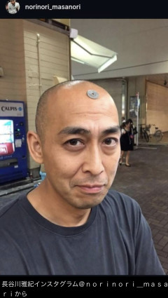 お笑いコンビ・錦鯉の長谷川雅紀さん、痩せて三島由紀夫さんみたいな顔になる （※画像あり）