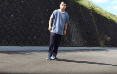 【画像】骨延長で175cmの身長を手に入れた人現るｗｗｗｗｗｗ