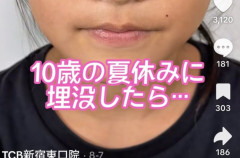【朗報】小4女子さん、二重整形で1軍女子の仲間入りを果たす・・・