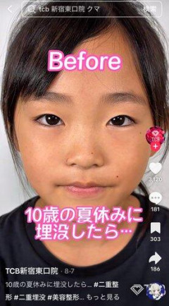 【朗報】小4女子さん、二重整形で1軍女子の仲間入りを果たすｗｗｗｗｗｗｗｗｗｗ