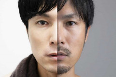 【疑問】「ヒゲの永久脱毛」をするゲイが急増している理由ｗｗｗｗ