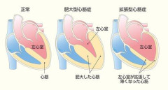 【悲報】8歳アイドル練習生が急死…インフル心筋炎声明と「あのワクチン」の波紋