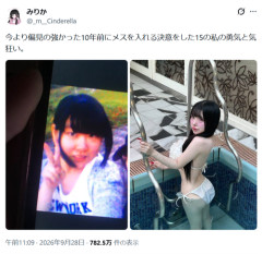 【画像】15歳で整形を決意した女の子、10年後の姿がこちらｗｗｗｗ