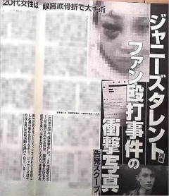【画像】ジャ◯ーズに殴られた女、思ってた以上に怪我が酷い…