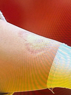 アジア大会…中国の女子柔道選手、日本人選手の腕に噛み付き反則負け [10/2]