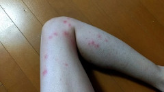 【画像】これ梅毒ちゃうよな？😰