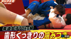 【アジア大会/柔道】中国選手が衝撃の反則負け　前田凛にガブリ噛みつき　歯形くっきり・・・女子70kg級(※動画あり)