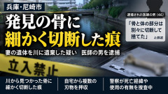 【速報】医師が妻をバラバラに 俺ら「関節で綺麗にバラしてそう」→骨肉完全分離&骨細断してました