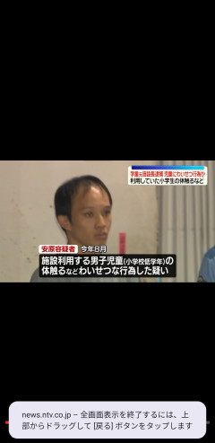 【驚愕】31歳でこんなハゲるものなのか？？？？？