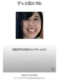 【悲報】有村架純の姉・有村藍里、整形前の顔を公開して「可哀相」「そりゃ整形したくなる」と心無い声
