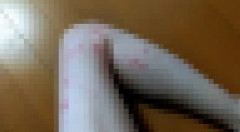 【画像】これ梅毒じゃないよな？？