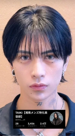 【悲報】歌舞伎町のホスト、額縮小手術で血流途絶えハゲる→「かわいそう」の声