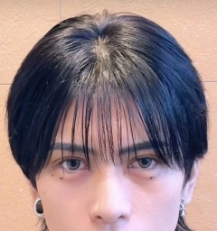 歌舞伎町のイケメンホストさんが整形手術をやった結果　ハゲてしまう・・・