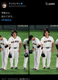 【画像】甲斐拓也の毛量、限界突破ｗｗｗｗｗｗｗｗｗｗｗ
