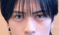【画像】デコ縮小手術をしたイケメンホストさん、血流が無くなり逝くｗｗｗｗｗ