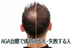 【悲報】ワイちゃん、AGA治療を決意