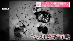【悲報】露ペスト、新たに別の職員も発症・・・・・・・・・