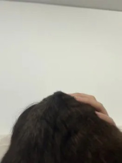 【悲報】ワイ、猫に襲われる（※画像あり）