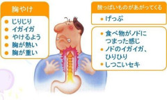 【悲報】逆流性食道炎ワイ、布団の上で吐いてしまうｗｗｗｗｗｗｗｗｗｗ