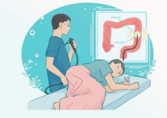 【悲報】大腸カメラ検査（鎮静剤あり）をお前らが意地でも受けない理由