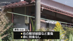 日本「玄関先でクマに襲われる 眼球破裂」←この生物を絶滅させない理由www