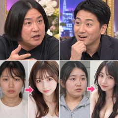 永野「整形して奇麗になってる人に魅力を感じない…男は性的に見てないと思う」ニューヨーク屋敷も「かわいくないほうが興奮する」   |  男は整形女を見抜いてないよね