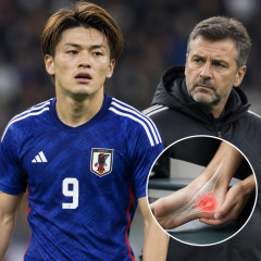 上田綺世、足底筋膜断裂で戦線離脱へ 指揮官「この種のけがの回復期間を見極めるのは複雑」   #サッカー |  日本人ってなんでこんな怪我しやすいんだ？