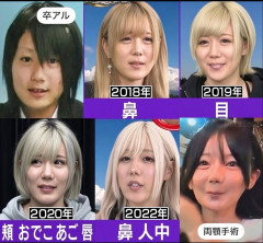 【画像】フェフ姉さんの多田さん、整形でガチで可愛くなるwwwwwwwwwwwwwwwwwwwww