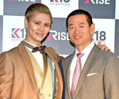 【悲報】Matt整形に１０００万以上使ってたｗｗｗｗ