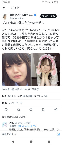 【画像】ブス、整形でめちゃくちゃ可愛くなる