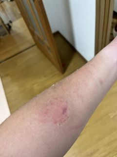 妻と喧嘩したら近隣から警察呼ばれて離婚寸前
