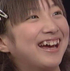 【悲報】辻希美、大がかりな治療で「若干顔が変わるかも」