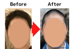 【画像】ハゲ男性、坊主にした結果イケメンになる