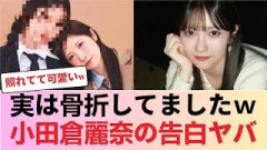 【櫻坂46】「実は骨折してました…」小田倉麗奈が照れながら明かした衝撃の真相ｗｗｗ #櫻坂46 #櫻坂46反応集