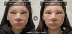 【画像】整形依存、恐ろしいと話題に