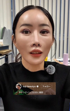 【画像】整形依存、恐ろしいと話題に・・・
