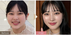 「もうやらない方がいい」　美容整形を繰り返す“整形沼”　経験20年以上の医師が語るリスクと限界