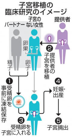 【速報】国内初の『子宮移植計画』始動。　