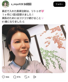 【画像】顔面注射したまんさん、無事マット化ｗｗｗｗｗｗｗｗ
